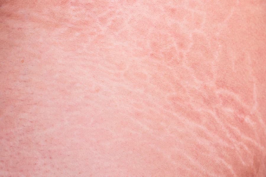 Example of skin with problems